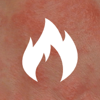 Flame