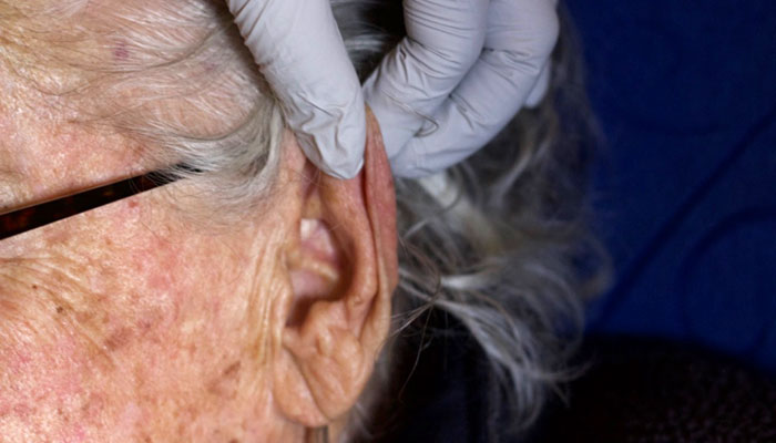 Gloved hand lifting ear lobe